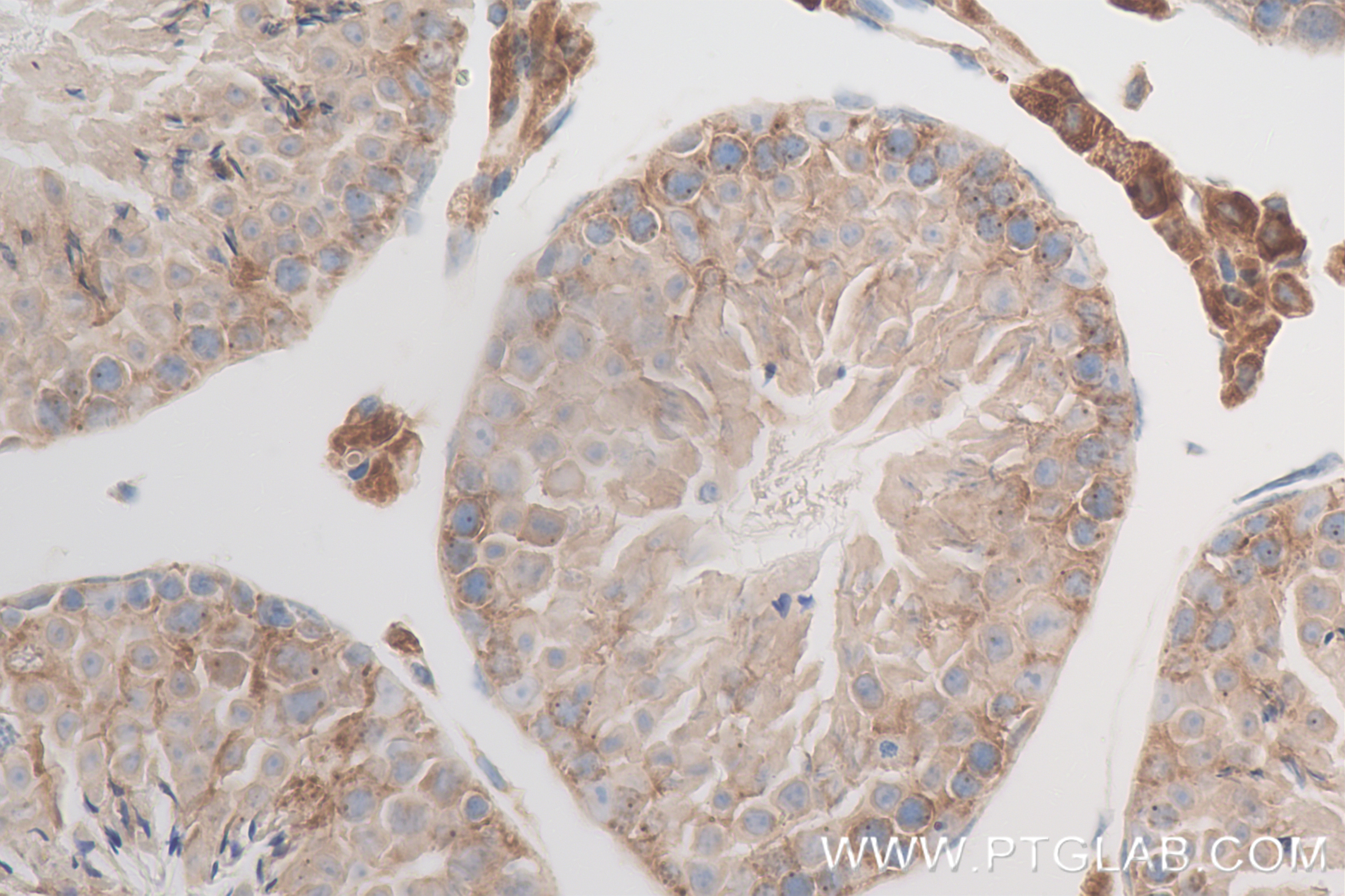 Immunohistochemistry (IHC) staining of mouse testis tissue using RAB21 Recombinant antibody (84776-2-RR)