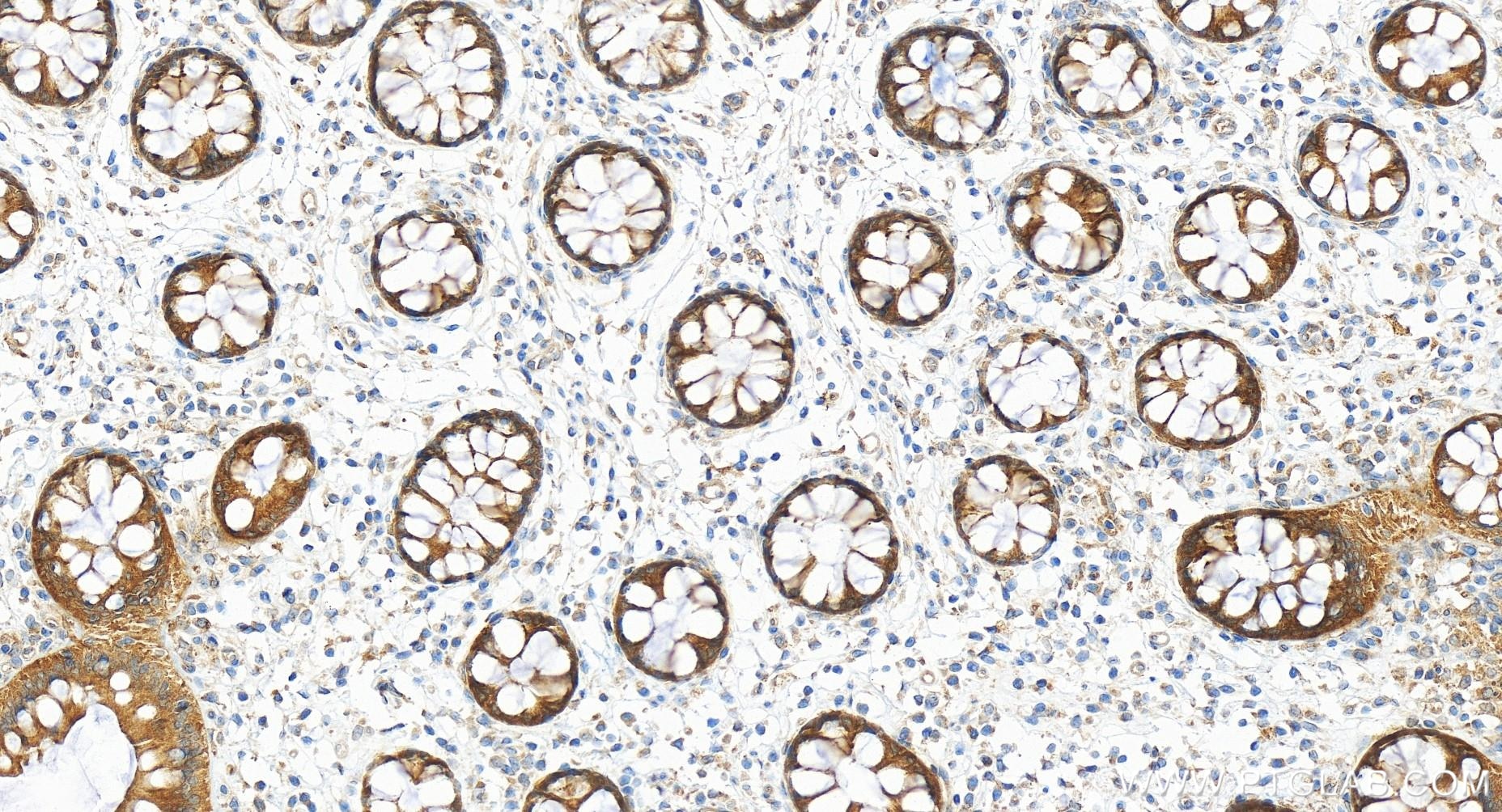 Immunohistochemistry (IHC) staining of human colon tissue using RAB21 Recombinant antibody (84776-2-RR)