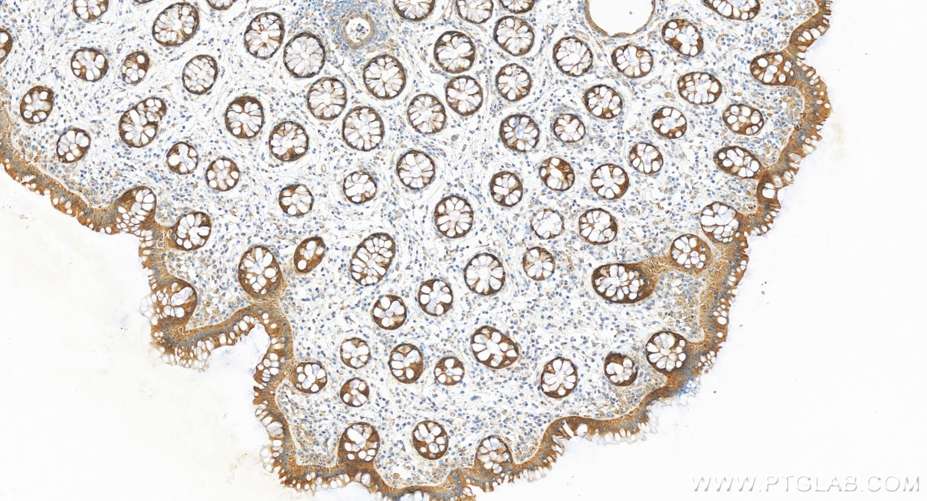 Immunohistochemistry (IHC) staining of human colon tissue using RAB21 Recombinant antibody (84776-2-RR)