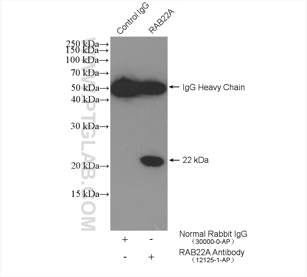 Immunoprecipitation (IP) experiment of COLO 320 cells using RAB22A Polyclonal antibody (12125-1-AP)