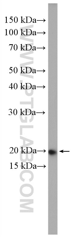 Western Blot (WB) analysis of A375 cells using RAB22A Polyclonal antibody (12125-1-AP)