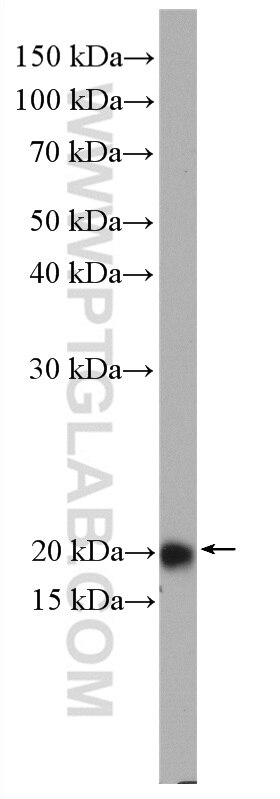 Western Blot (WB) analysis of COLO 320 cells using RAB22A Polyclonal antibody (12125-1-AP)
