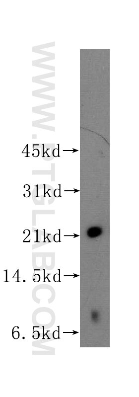 Western Blot (WB) analysis of Jurkat cells using RAB22A Polyclonal antibody (12125-1-AP)