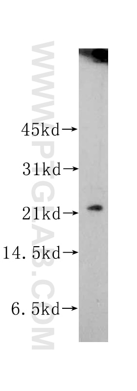 Western Blot (WB) analysis of BxPC-3 cells using RAB22A Polyclonal antibody (12125-1-AP)
