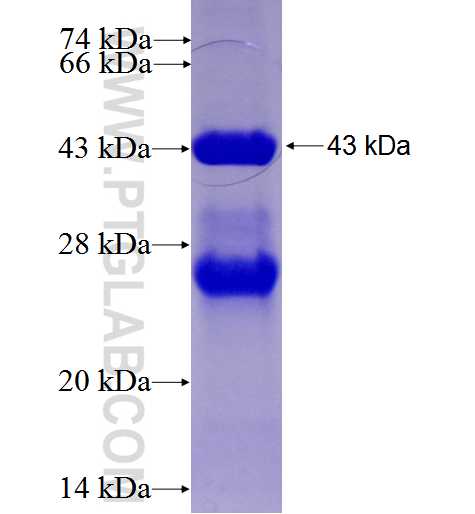 RAB22A fusion protein Ag2769 SDS-PAGE