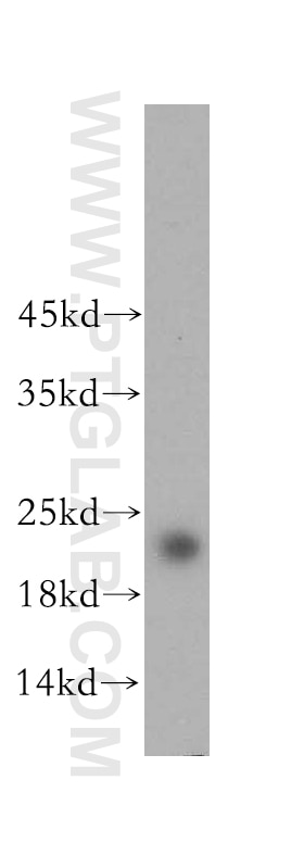 Western Blot (WB) analysis of HEK-293 cells using RAB22A-specific Polyclonal antibody (16181-1-AP)