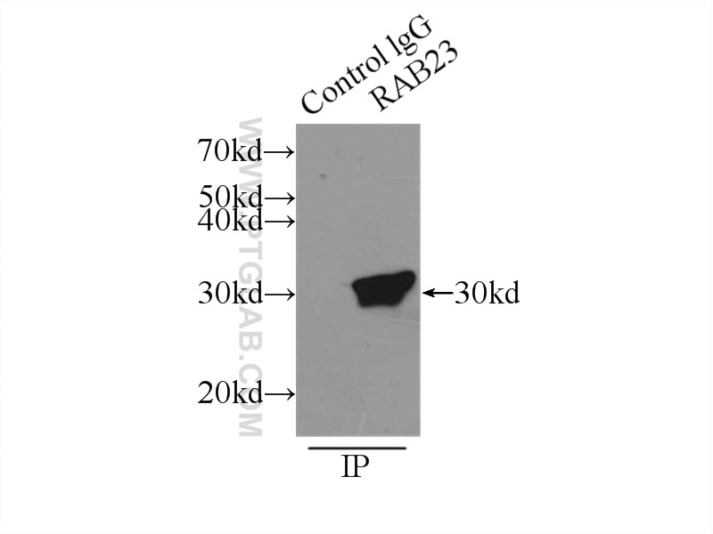 IP experiment of mouse brain using 11101-1-AP