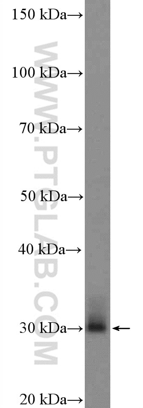 Western Blot (WB) analysis of rat brain tissue using Rab23 Polyclonal antibody (11101-1-AP)