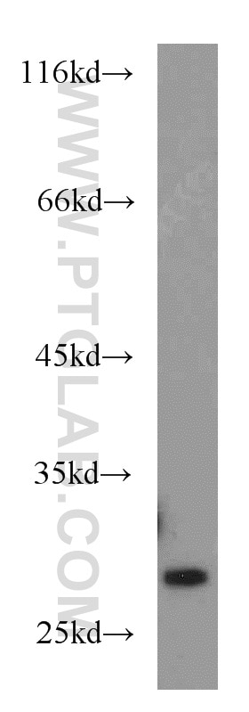 Western Blot (WB) analysis of mouse brain tissue using Rab23 Polyclonal antibody (11101-1-AP)