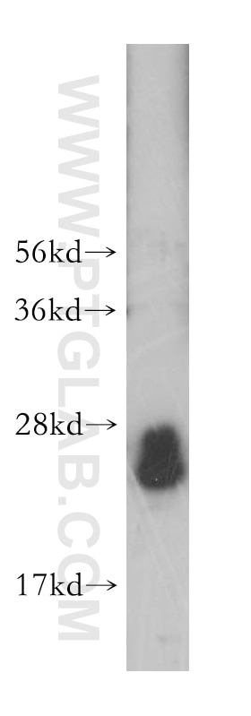 Western Blot (WB) analysis of human brain tissue using Rab23 Polyclonal antibody (11101-1-AP)