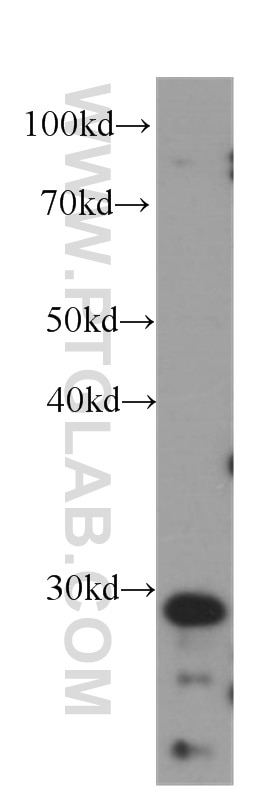 Western Blot (WB) analysis of human brain tissue using Rab23 Monoclonal antibody (60056-1-Ig)