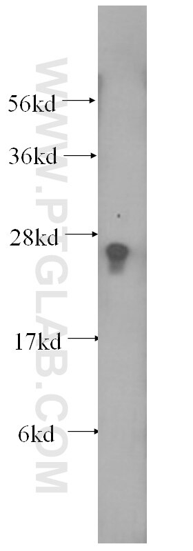 Western Blot (WB) analysis of HeLa cells using Rab23 Monoclonal antibody (60056-1-Ig)