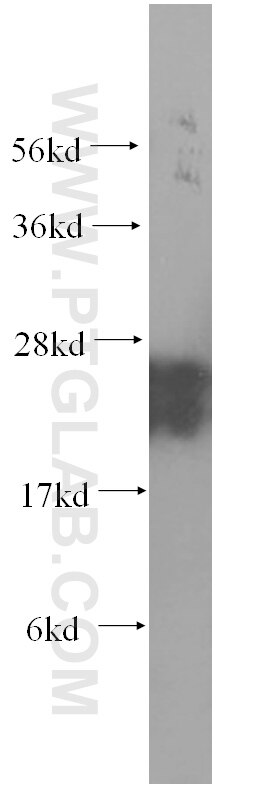 Western Blot (WB) analysis of human brain tissue using Rab23 Monoclonal antibody (60056-1-Ig)