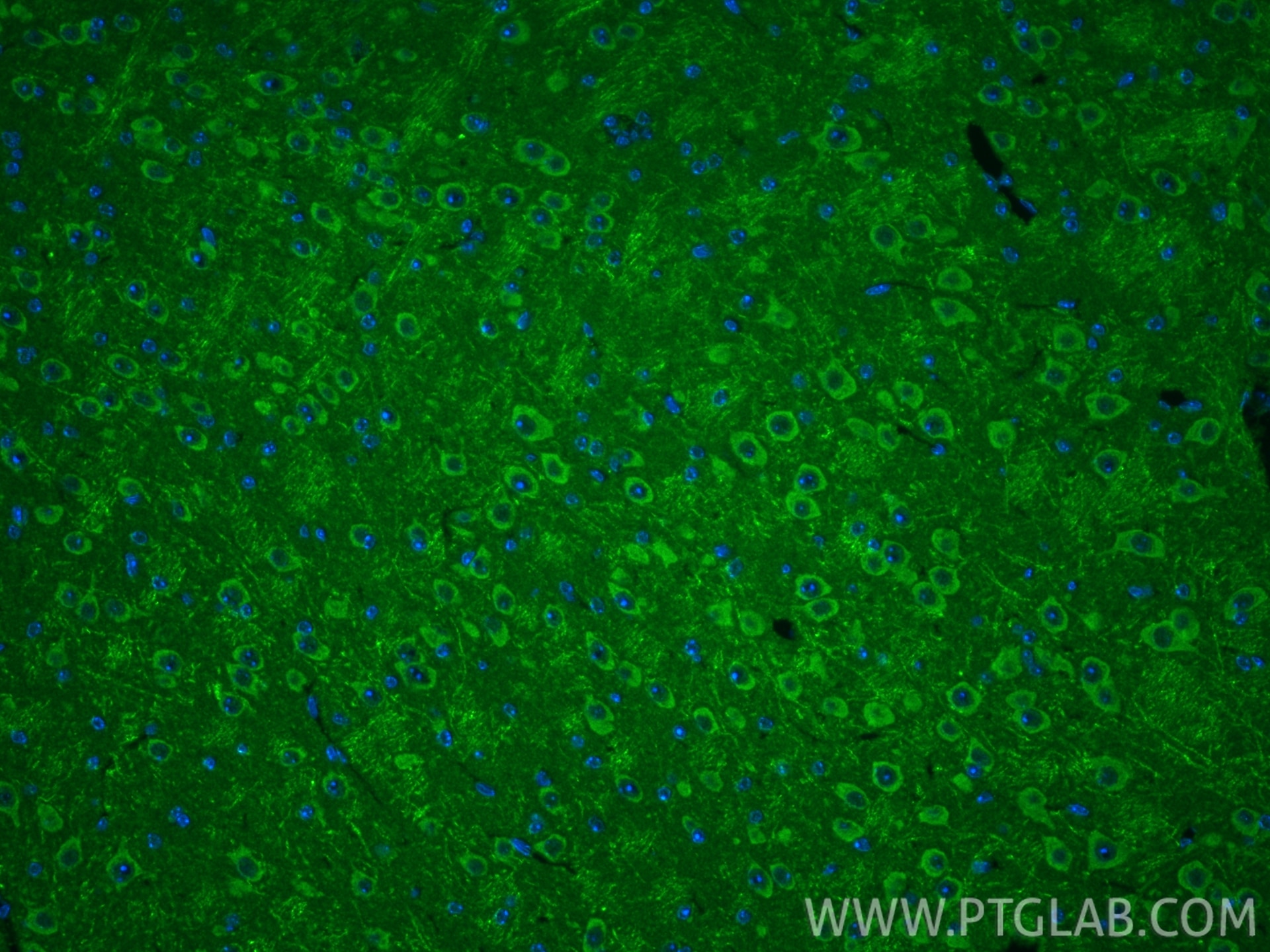 Immunofluorescence (IF) / fluorescent staining of mouse brain tissue using RAB24 Polyclonal antibody (11445-1-AP)