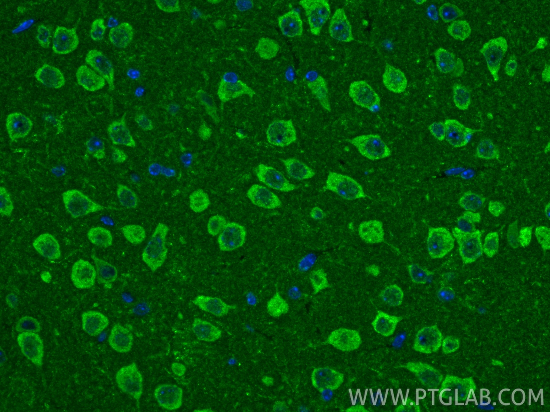 Immunofluorescence (IF) / fluorescent staining of mouse brain tissue using RAB24 Polyclonal antibody (11445-1-AP)