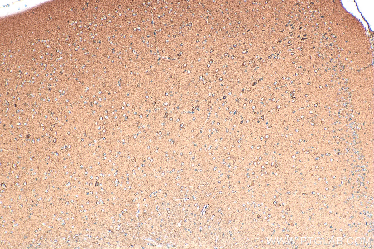 Immunohistochemistry (IHC) staining of mouse brain tissue using RAB24 Polyclonal antibody (11445-1-AP)