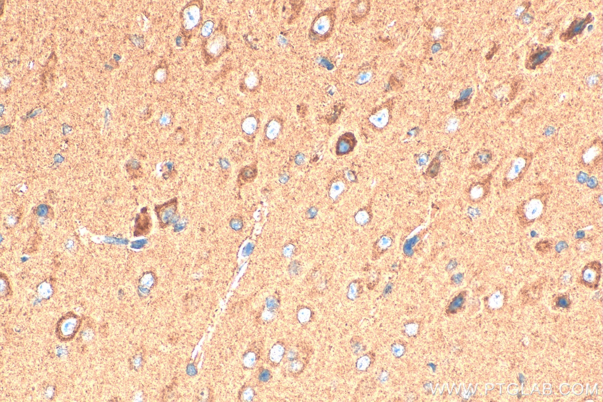 Immunohistochemistry (IHC) staining of mouse brain tissue using RAB24 Polyclonal antibody (11445-1-AP)