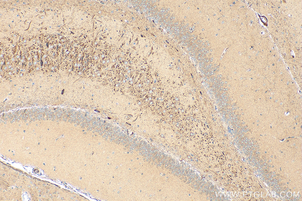 Immunohistochemical analysis of paraffin-embedded rat brain tissue slide using 11445-1-AP (RAB24 antibody) at dilution of 1:400 (under 10x lens). Heat mediated antigen retrieval with Tris-EDTA buffer (pH 9.0). Immunohistochemistry (IHC) staining of rat brain tissue using RAB24 Polyclonal antibody (11445-1-AP)