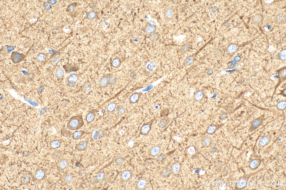 Immunohistochemical analysis of paraffin-embedded rat brain tissue slide using 11445-1-AP (RAB24 antibody) at dilution of 1:400 (under 40x lens). Heat mediated antigen retrieval with Tris-EDTA buffer (pH 9.0). Immunohistochemistry (IHC) staining of rat brain tissue using RAB24 Polyclonal antibody (11445-1-AP)