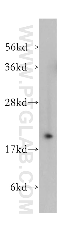 Western Blot (WB) analysis of human skeletal muscle tissue using RAB24 Polyclonal antibody (11445-1-AP)