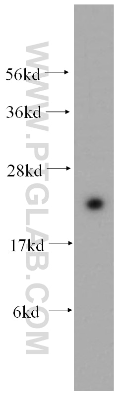 Western Blot (WB) analysis of HEK-293 cells using RAB24 Polyclonal antibody (11445-1-AP)