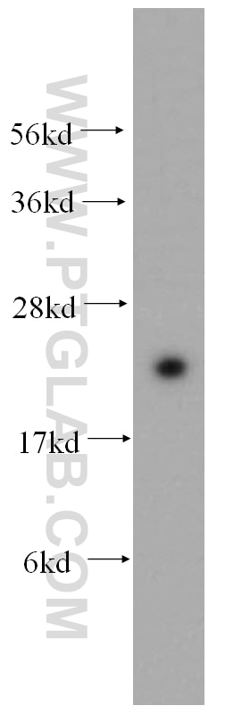 WB analysis of HEK-293 using 11445-1-AP