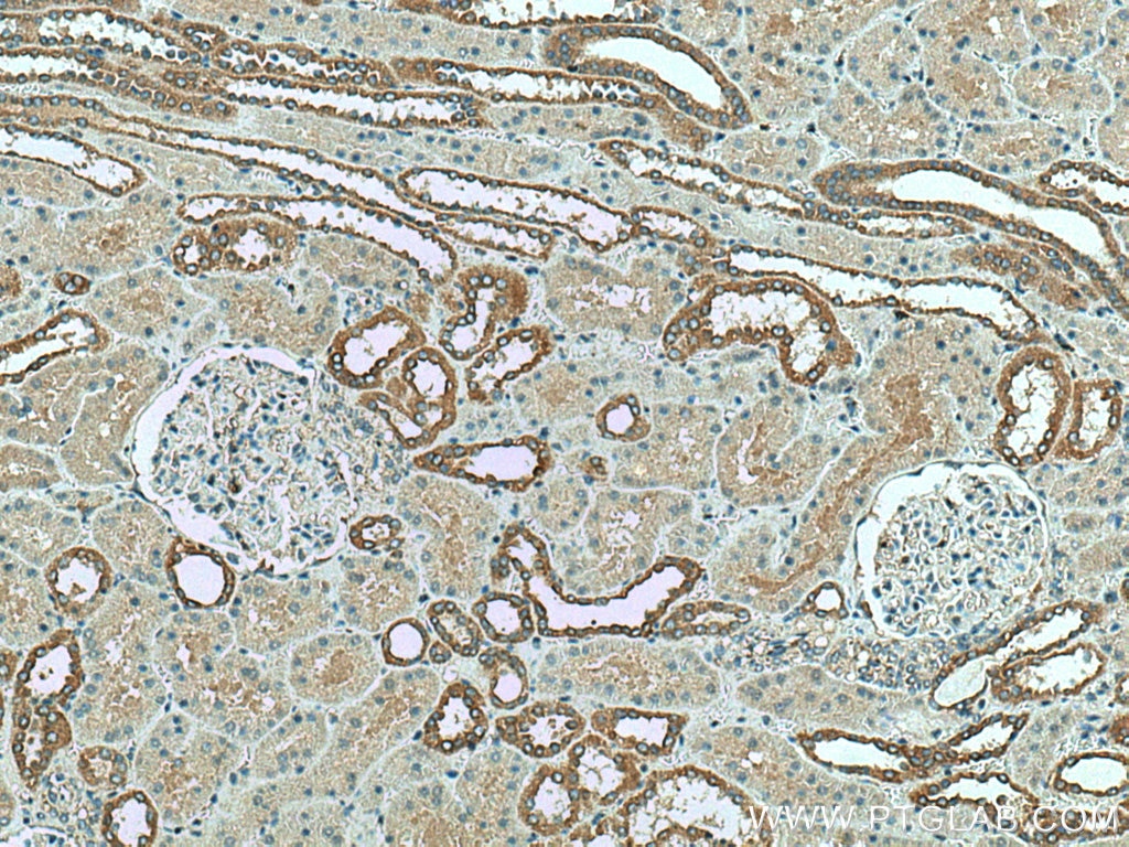 Immunohistochemistry (IHC) staining of human kidney tissue using RAB25 Polyclonal antibody (13189-1-AP)