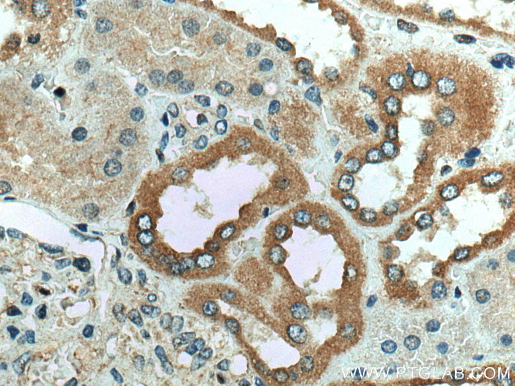 IHC staining of human kidney using 13189-1-AP