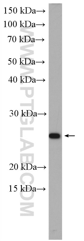 WB analysis of Caco-2 using 13189-1-AP