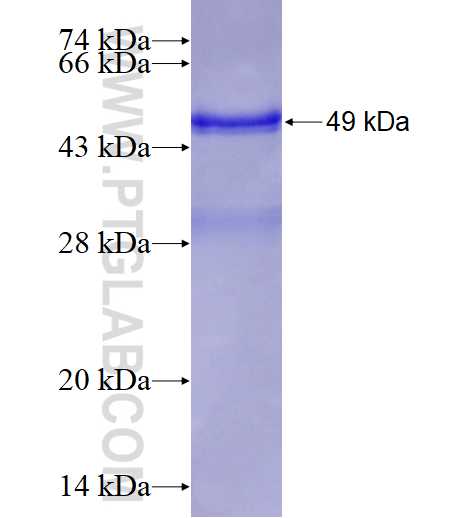 RAB25 fusion protein Ag3864 SDS-PAGE