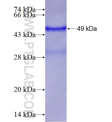 RAB25 fusion protein Ag3864 SDS-PAGE