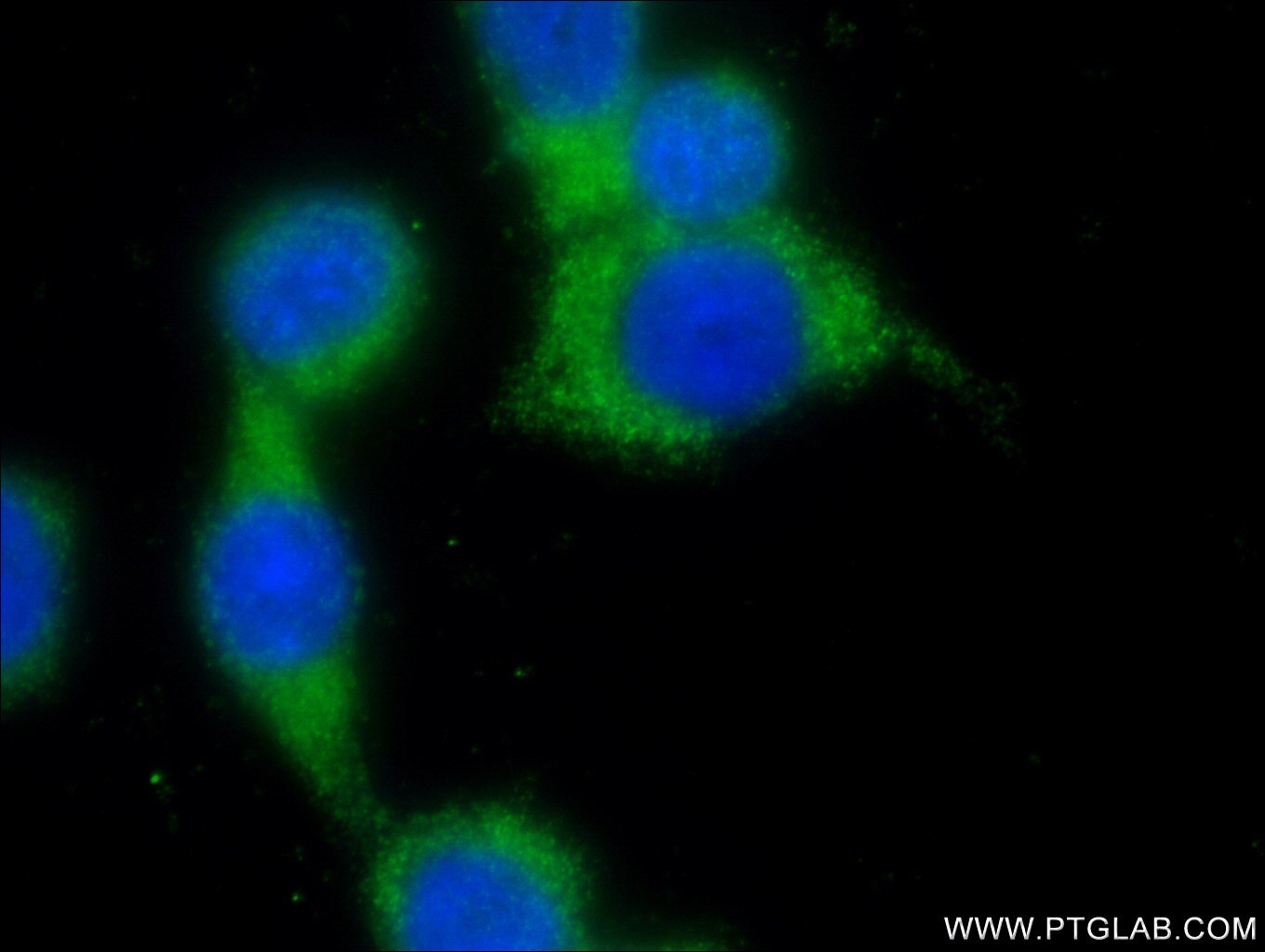 Immunofluorescence (IF) / fluorescent staining of BxPC-3 cells using RAB26 Polyclonal antibody (14284-1-AP)