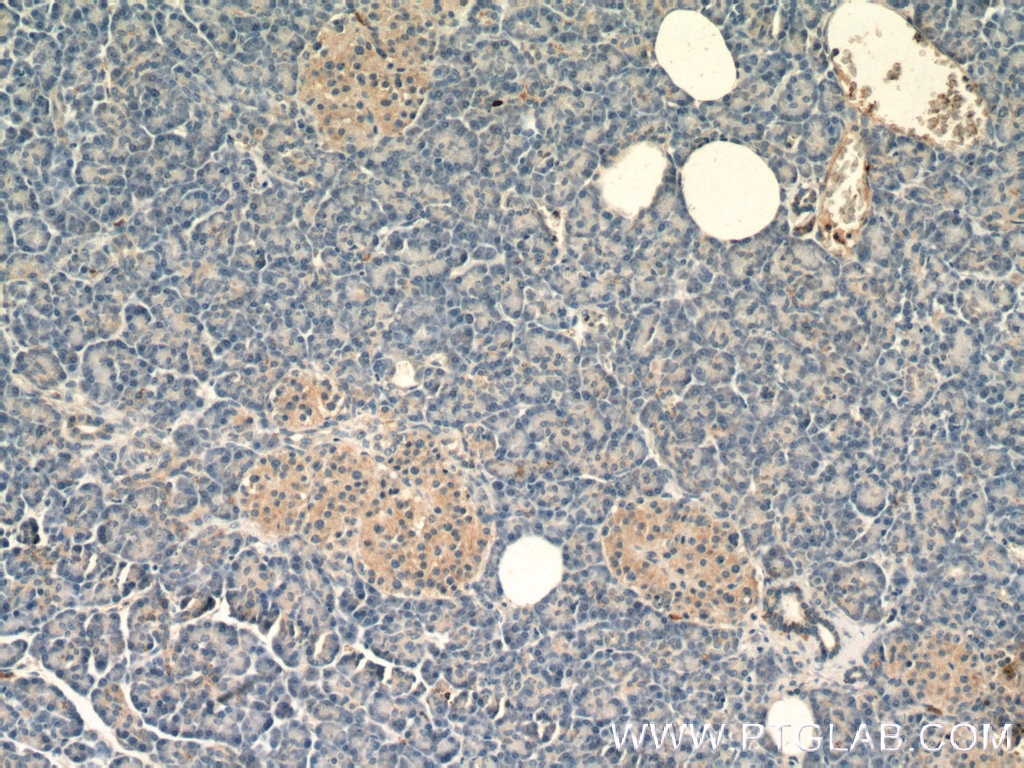 Immunohistochemistry (IHC) staining of human pancreas tissue using RAB26 Polyclonal antibody (14284-1-AP)