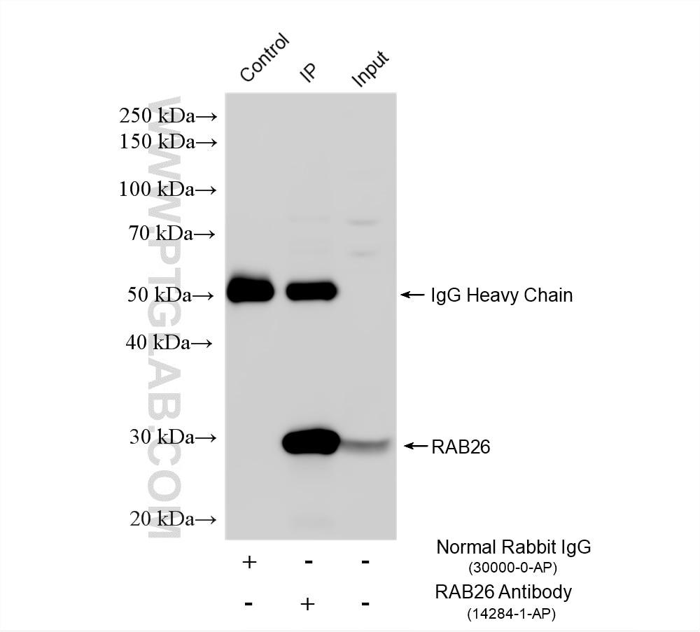 IP experiment of mouse pancreas using 14284-1-AP Immunoprecipitation (IP) experiment of mouse pancreas tissue using RAB26 Polyclonal antibody (14284-1-AP)