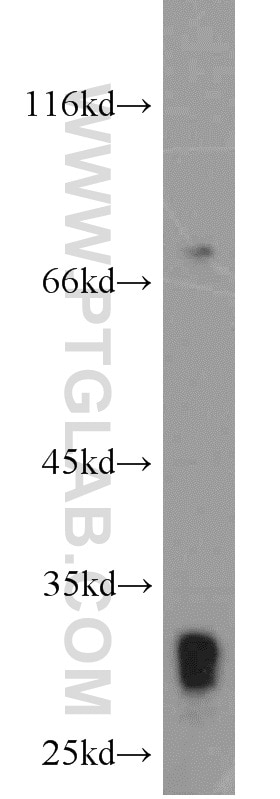 WB analysis of mouse pancreas using 14284-1-AP