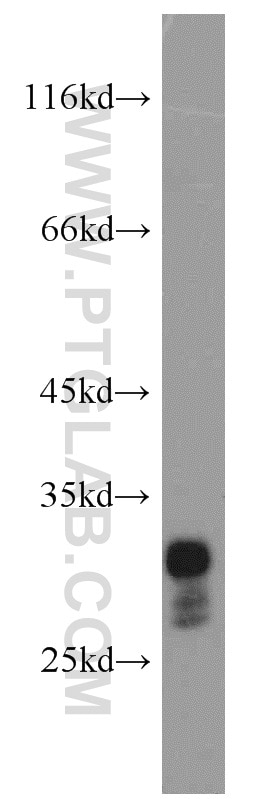 Western Blot (WB) analysis of mouse pancreas tissue using RAB26 Polyclonal antibody (14284-1-AP)