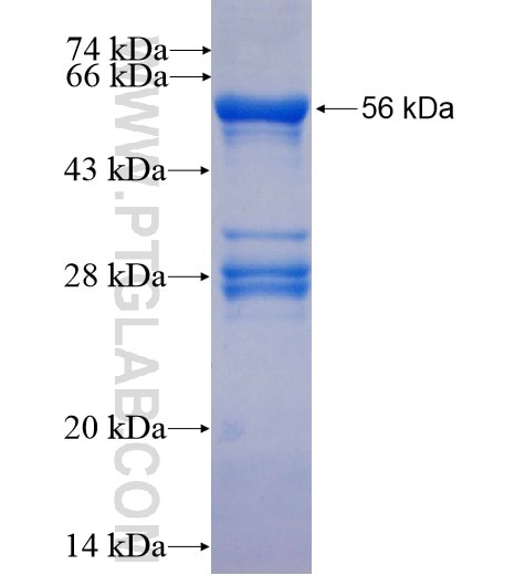 RAB26 fusion protein Ag5581 SDS-PAGE