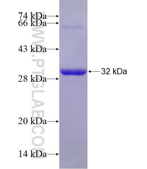 RAB26 fusion protein Ag6463 SDS-PAGE