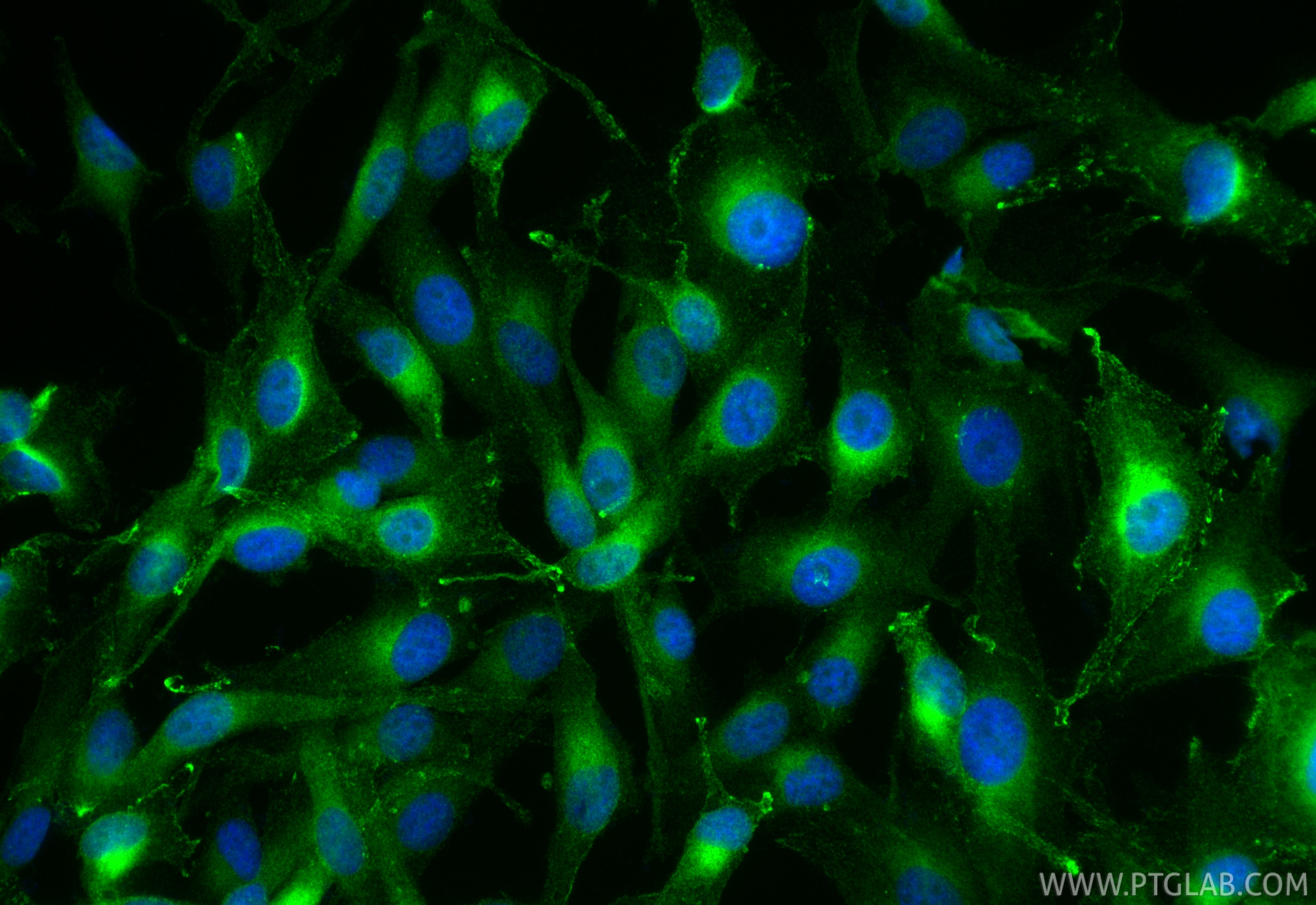 IF Staining of SK-MEL-28 using 17817-1-AP Immunofluorescence (IF) / fluorescent staining of SK-MEL-28 cells using RAB27A Polyclonal antibody (17817-1-AP)