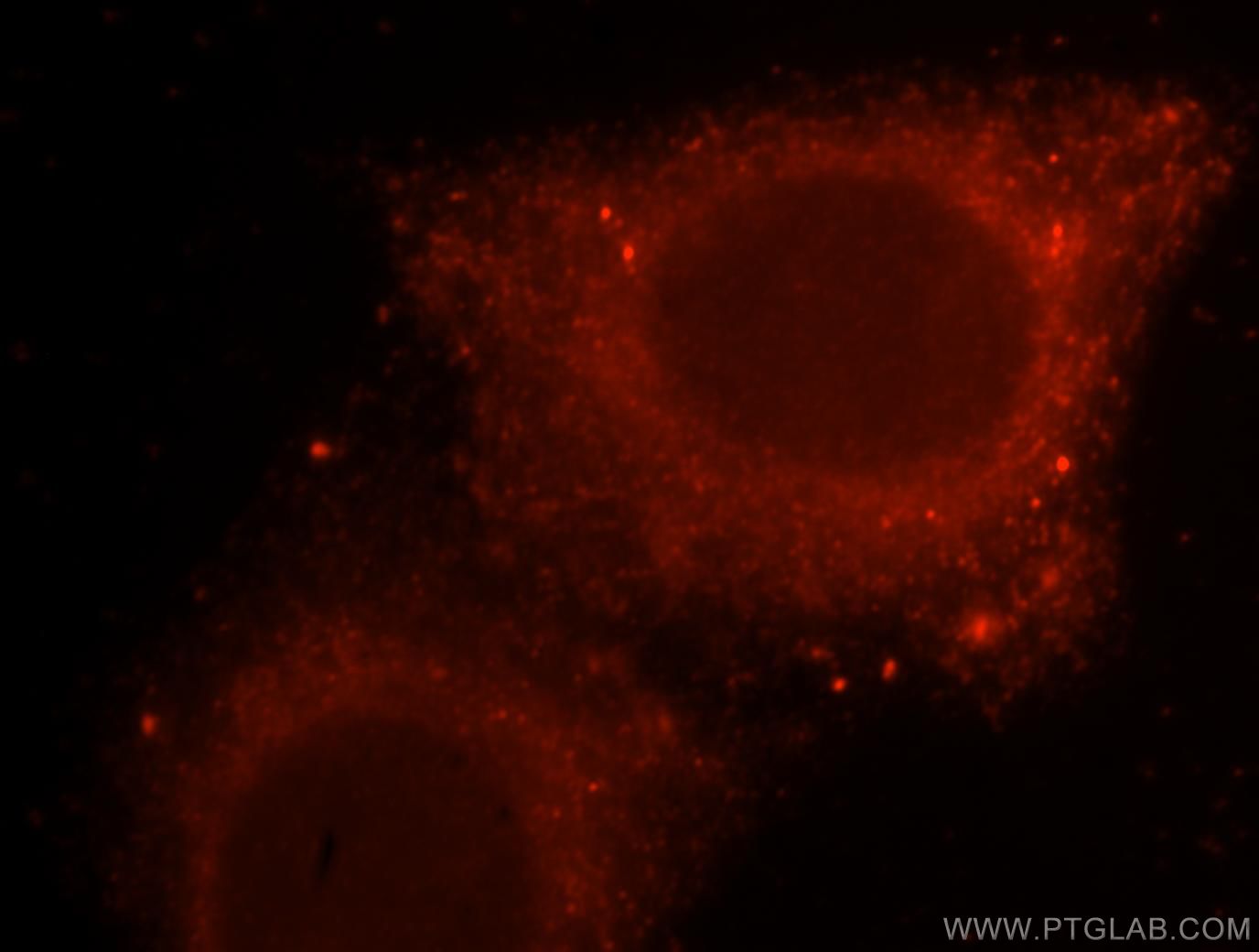 RAB27A Polyclonal antibody