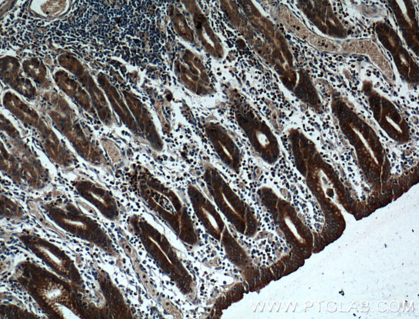 Immunohistochemistry (IHC) staining of human stomach tissue using RAB27A Polyclonal antibody (17817-1-AP)