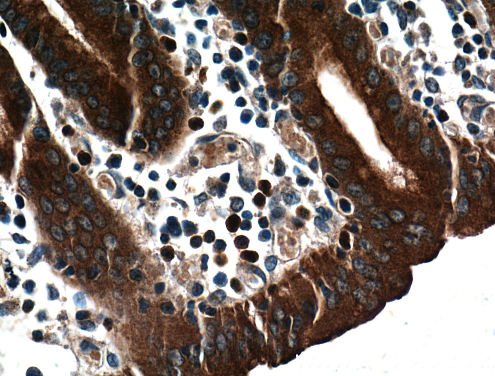 Immunohistochemistry (IHC) staining of human stomach tissue using RAB27A Polyclonal antibody (17817-1-AP)
