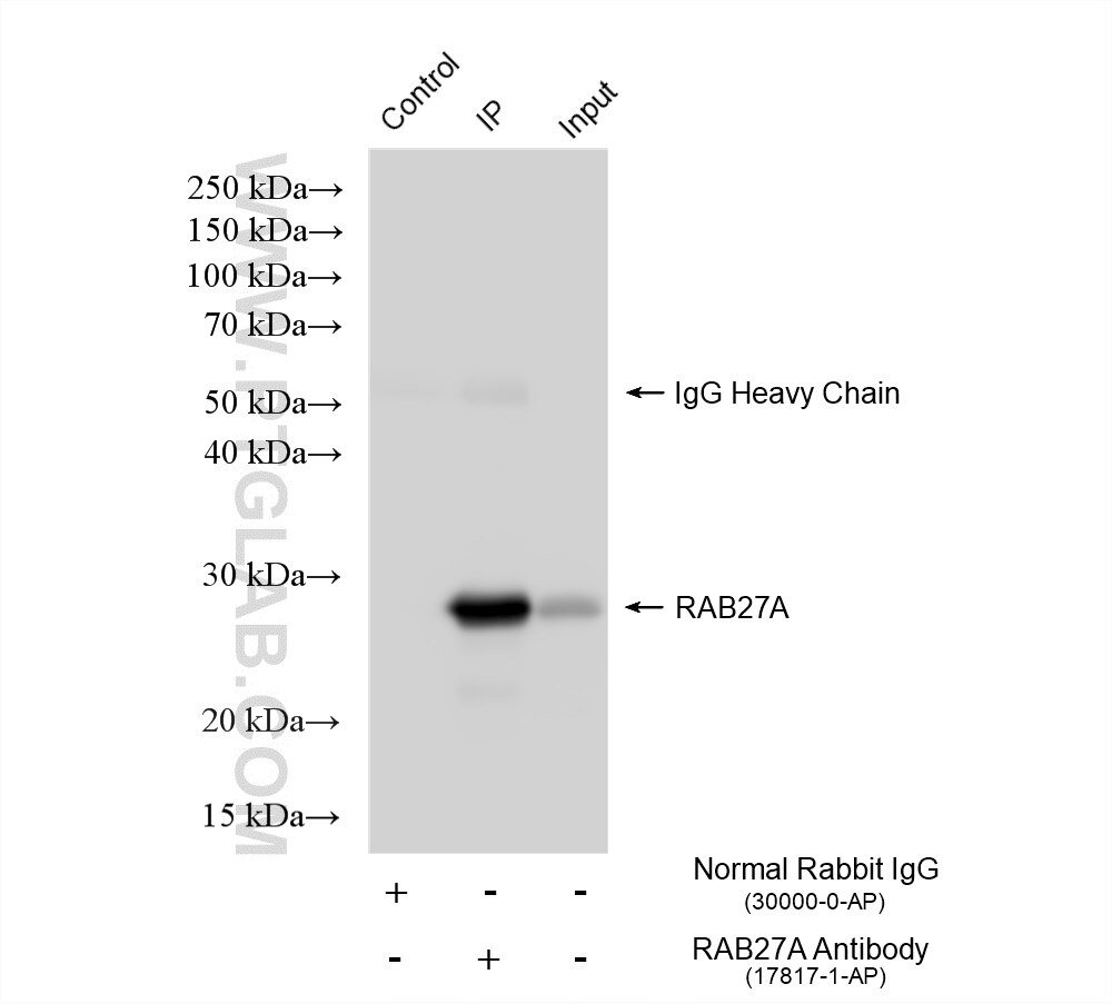 IP experiment of HL-60 using 17817-1-AP Immunoprecipitation (IP) experiment of HL-60 cells using RAB27A Polyclonal antibody (17817-1-AP)