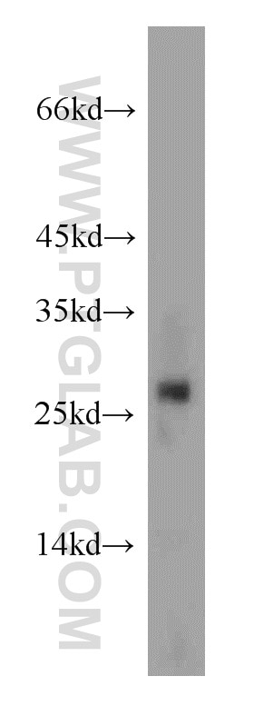 Western Blot (WB) analysis of human liver tissue using RAB27A Polyclonal antibody (17817-1-AP)