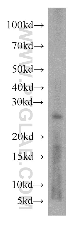Western Blot (WB) analysis of Apoptosised HeLa cells using RAB27A Polyclonal antibody (17817-1-AP)