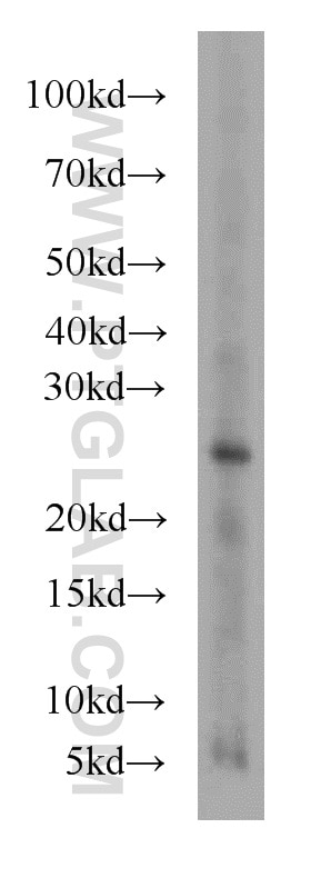 Western Blot (WB) analysis of L02 cells using RAB27A Polyclonal antibody (17817-1-AP)