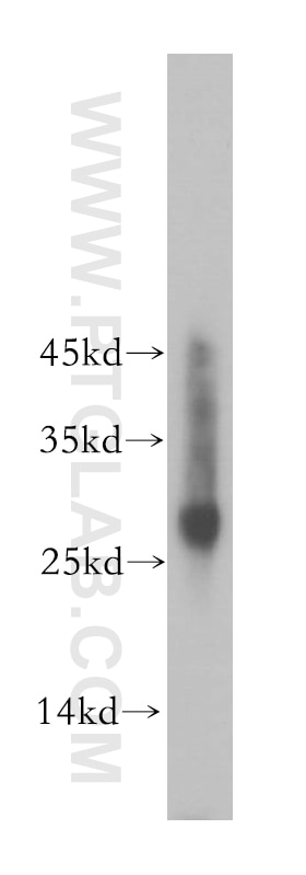 Western Blot (WB) analysis of HeLa cells using RAB27A Polyclonal antibody (17817-1-AP)