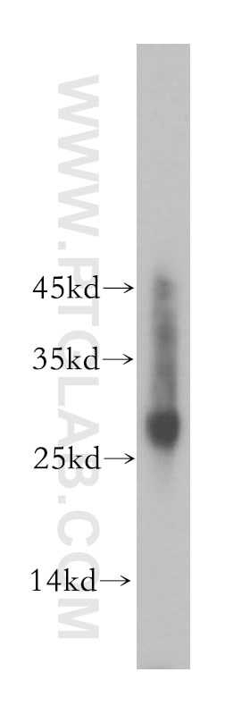 WB analysis of HeLa using 17817-1-AP