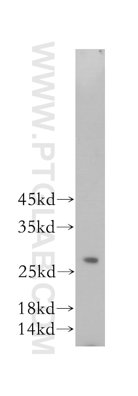 RAB27A Polyclonal antibody