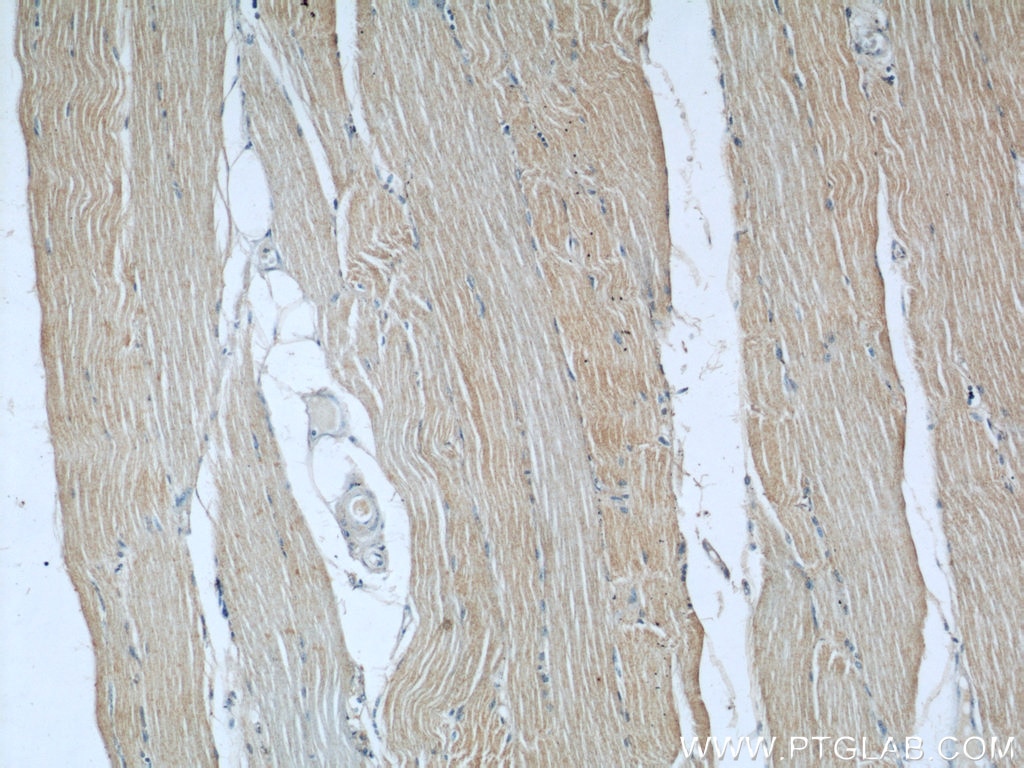 IHC staining of human skeletal muscle using 66058-1-Ig